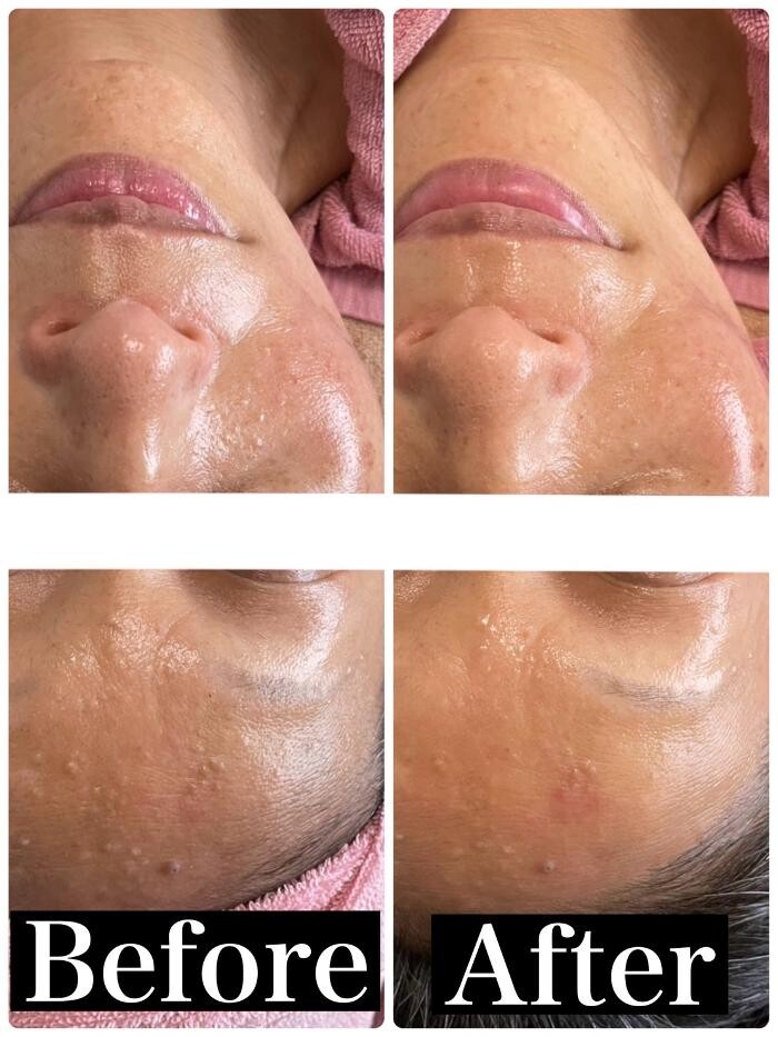 Images お顔そりとバザルトエステ凜