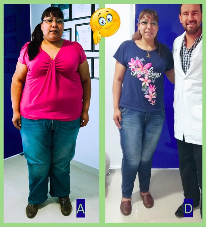 Images Obesity Health - Centro de Cirugía para la Obesidad