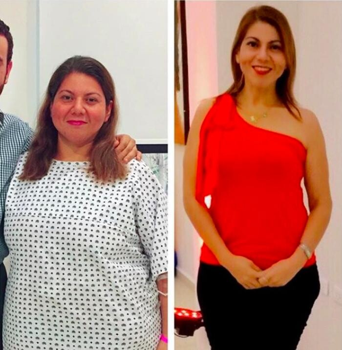 Images Obesity Health - Centro de Cirugía para la Obesidad