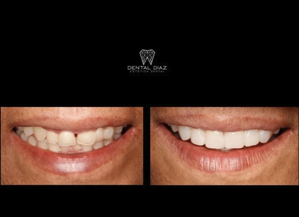 Images Dental Díaz Estética Dental