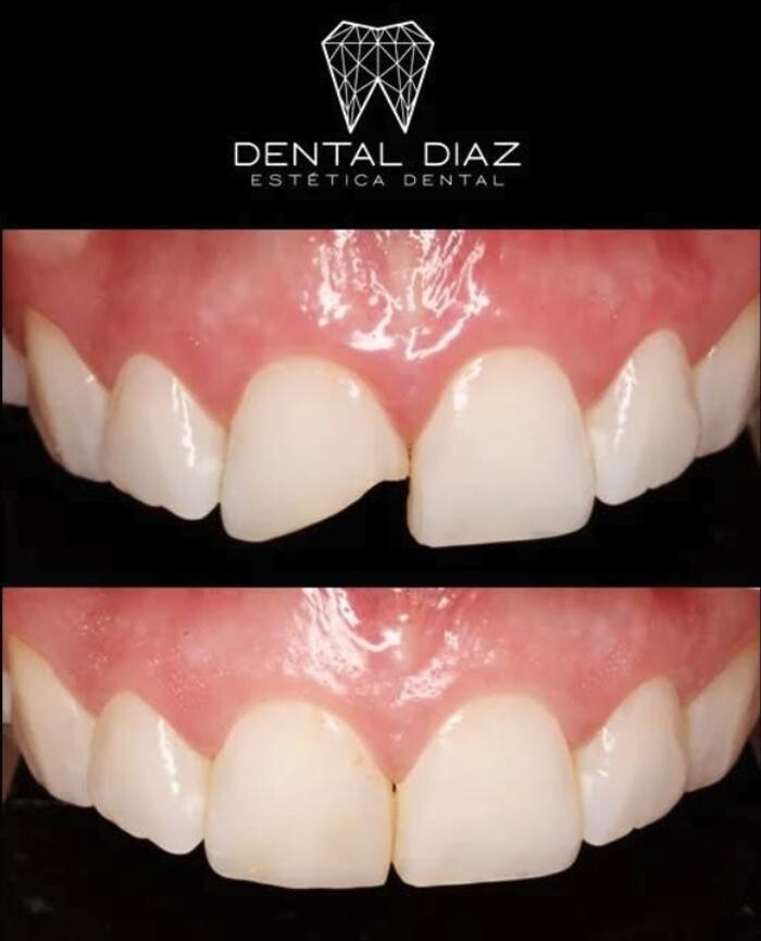 Images Dental Díaz Estética Dental