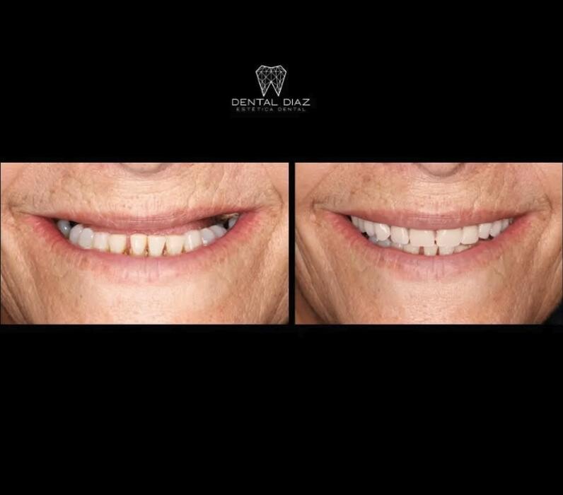 Images Dental Díaz Estética Dental