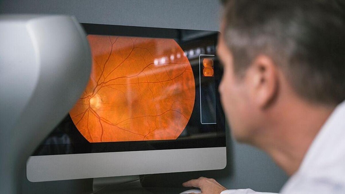 Images Ocular360 Oftalmólogo Santa Fe | Retinólogo Atlacomulco