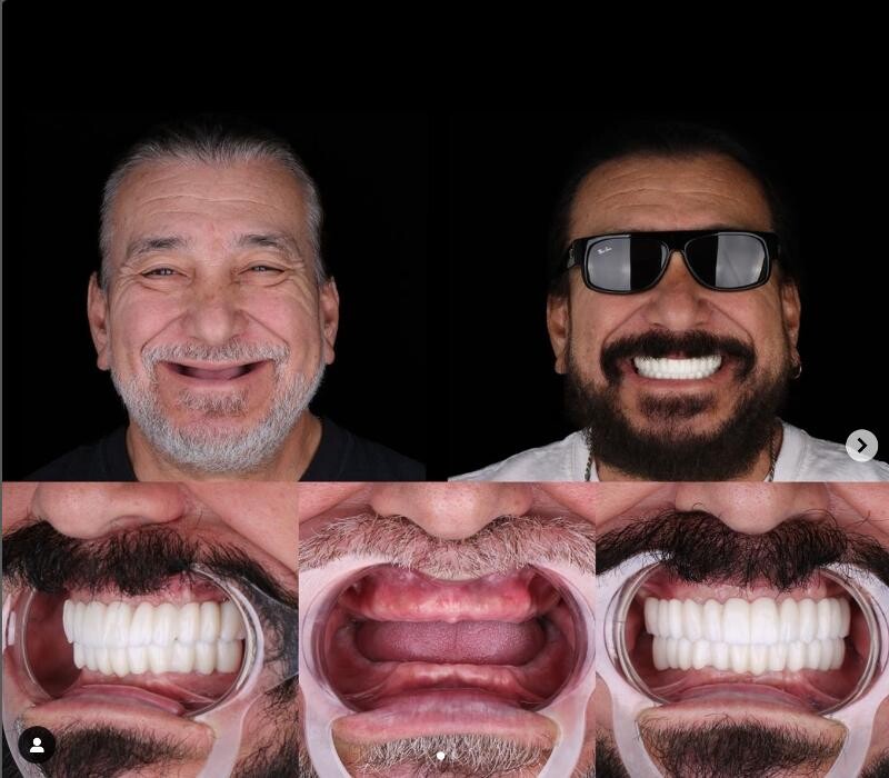 Images Supreme Dental Clinic