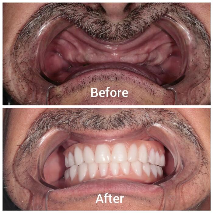 Images Supreme Dental Clinic