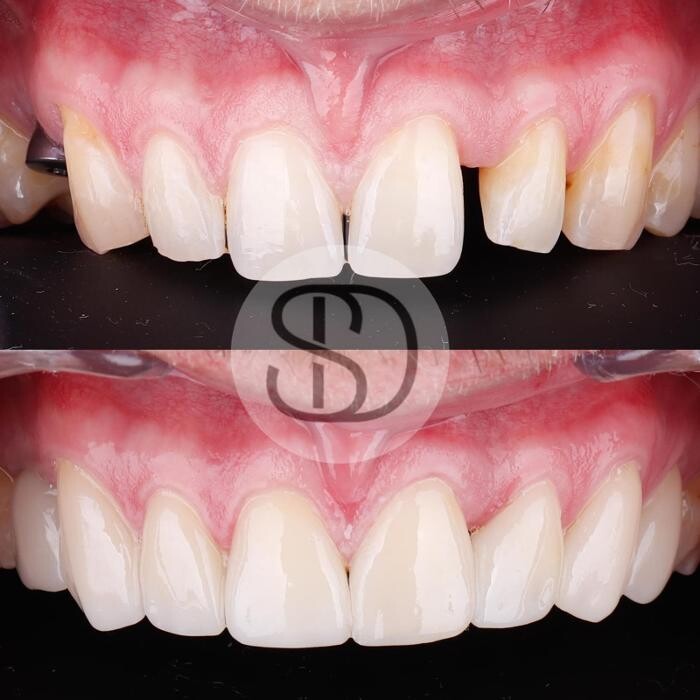 Images Supreme Dental Clinic