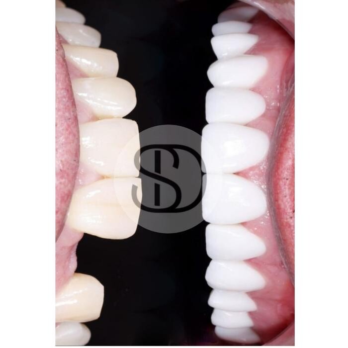 Images Supreme Dental Clinic