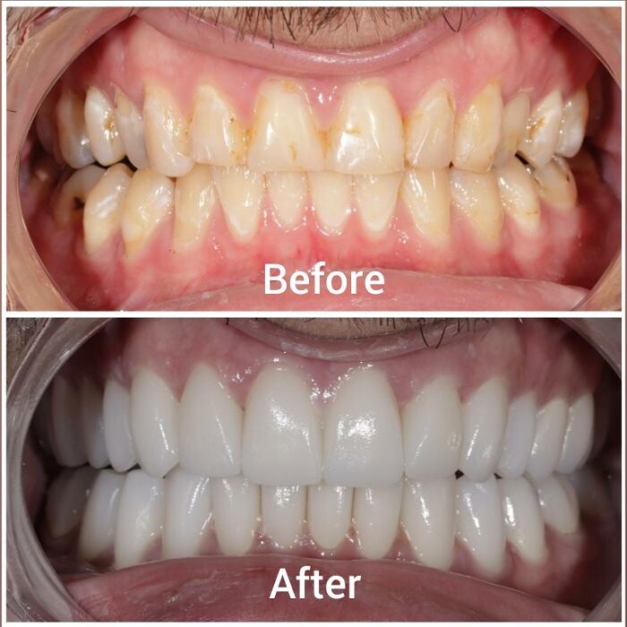 Images Supreme Dental Clinic