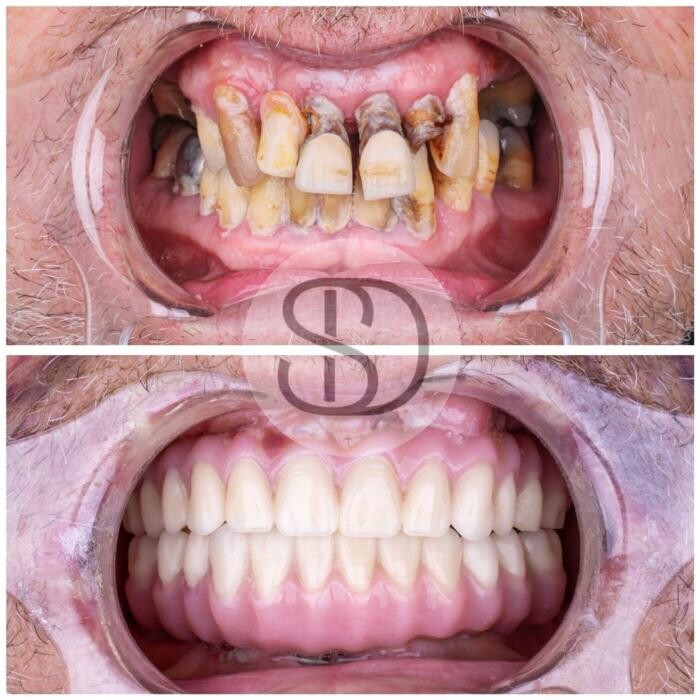 Images Supreme Dental Clinic