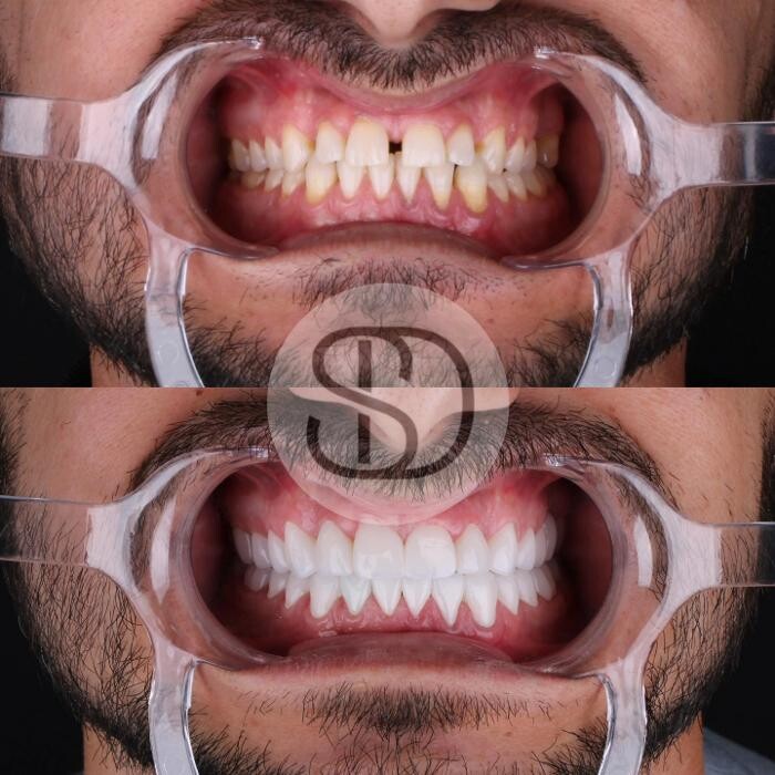 Images Supreme Dental Clinic