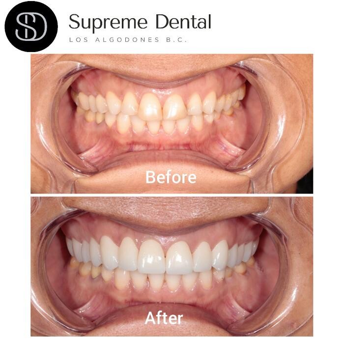 Images Supreme Dental Clinic