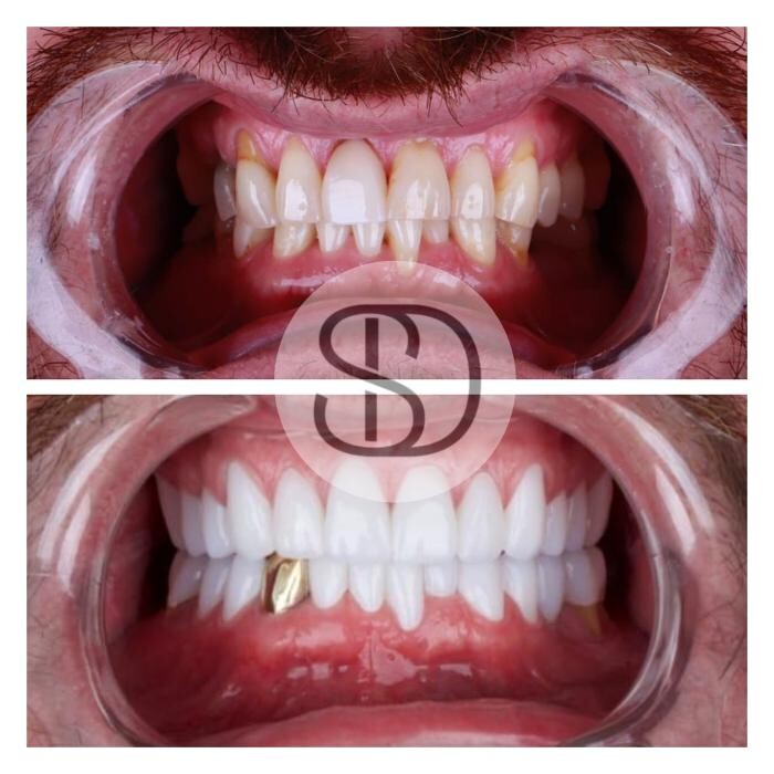 Images Supreme Dental Clinic
