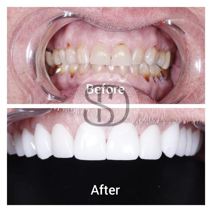 Images Supreme Dental Clinic