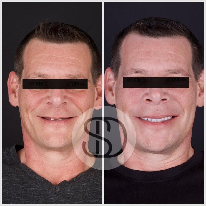 Images Supreme Dental Clinic