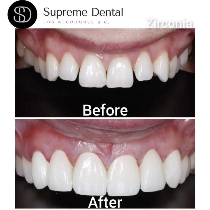 Images Supreme Dental Clinic