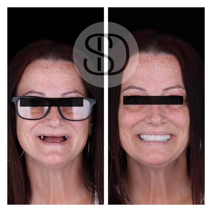 Images Supreme Dental Clinic