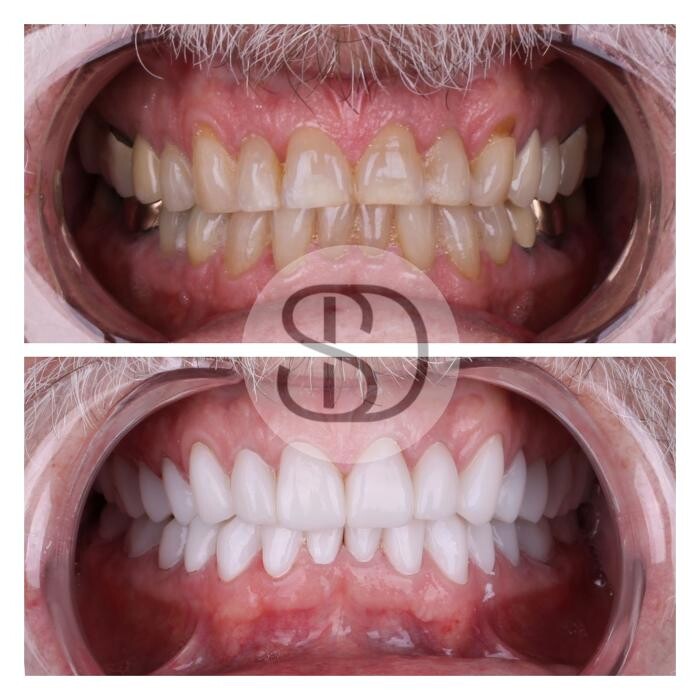 Images Supreme Dental Clinic