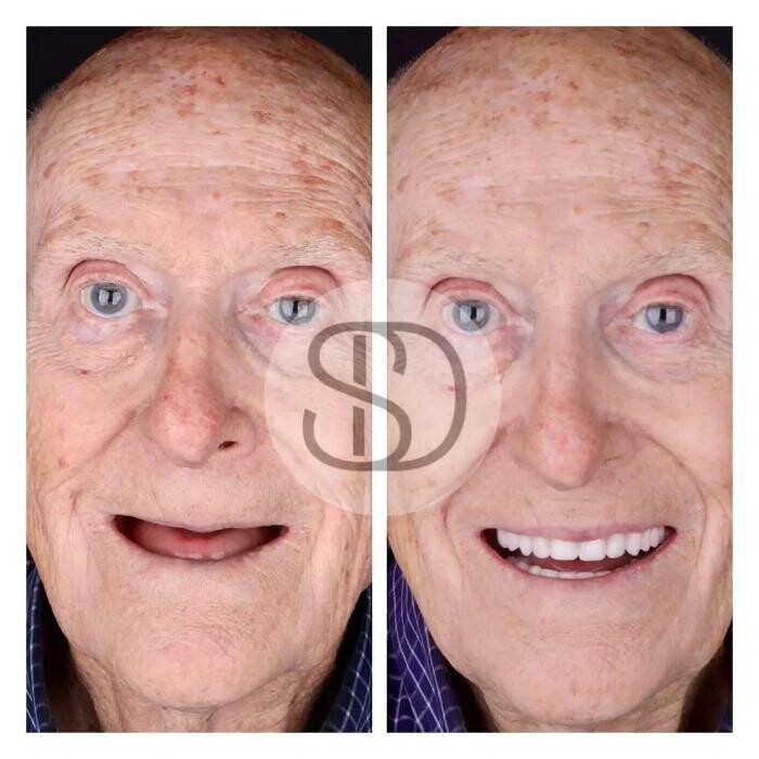 Images Supreme Dental Clinic