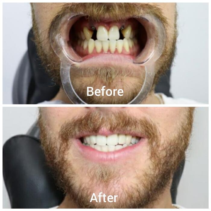 Images Supreme Dental Clinic