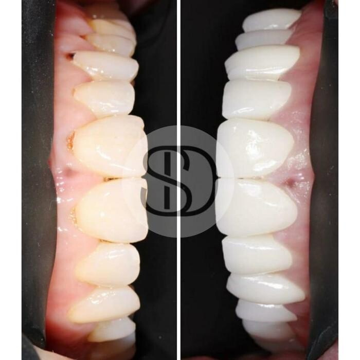 Images Supreme Dental Clinic