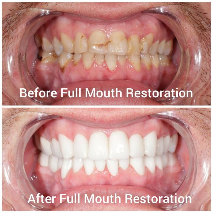 Images Supreme Dental Clinic