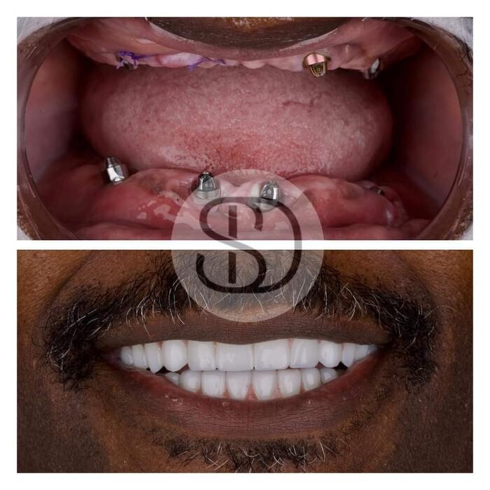 Images Supreme Dental Clinic