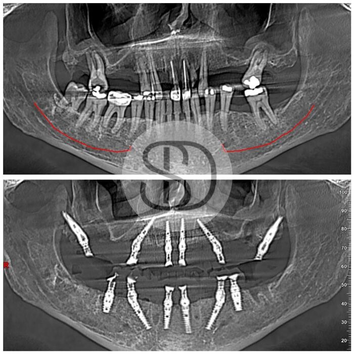 Images Supreme Dental Clinic