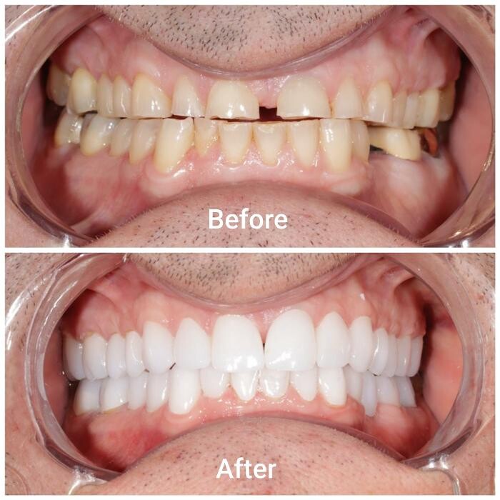 Images Supreme Dental Clinic