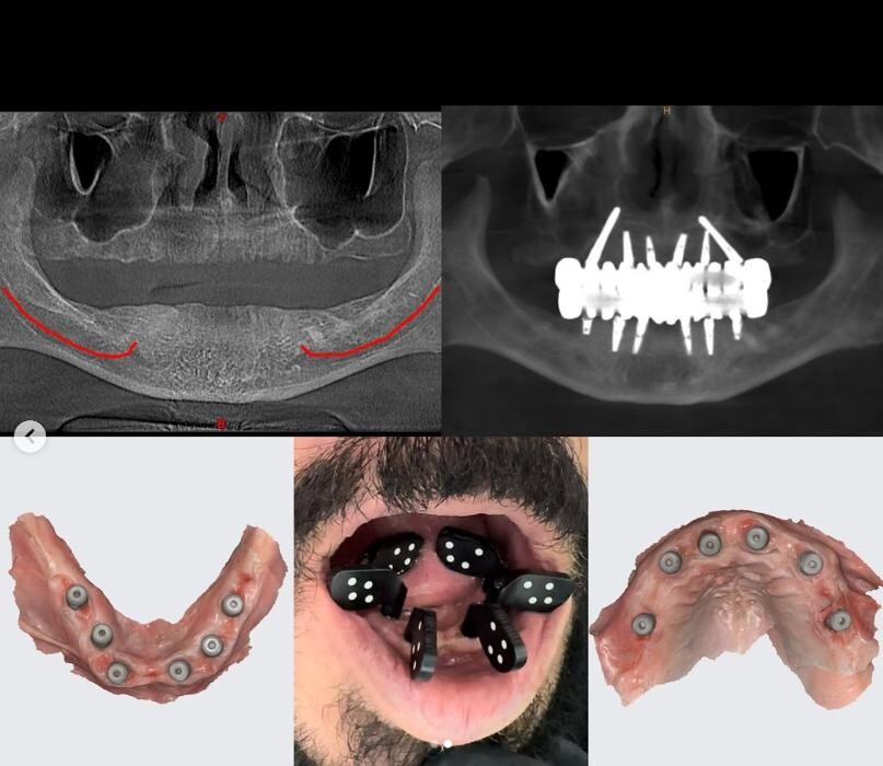 Images Supreme Dental Clinic