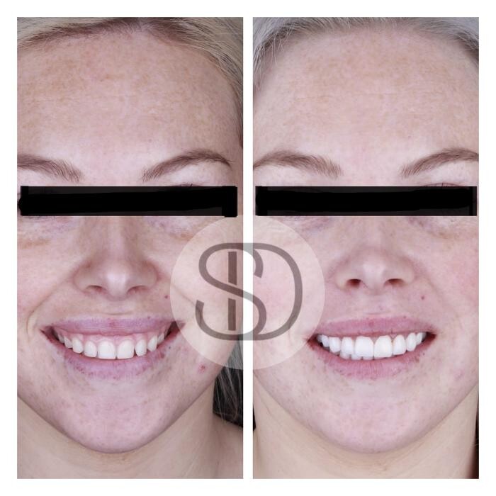 Images Supreme Dental Clinic