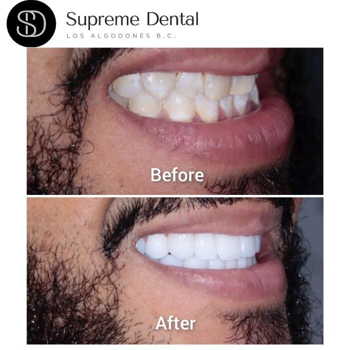 Images Supreme Dental Clinic