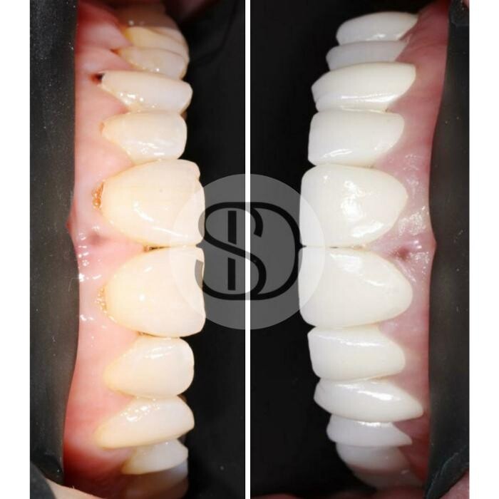 Images Supreme Dental Clinic