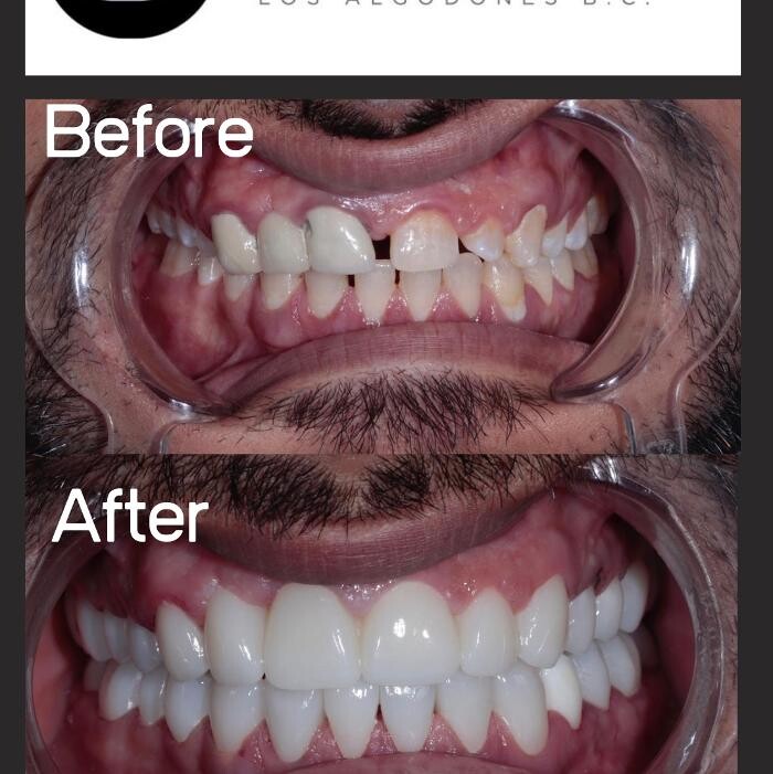 Images Supreme Dental Clinic