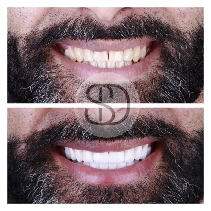 Images Supreme Dental Clinic