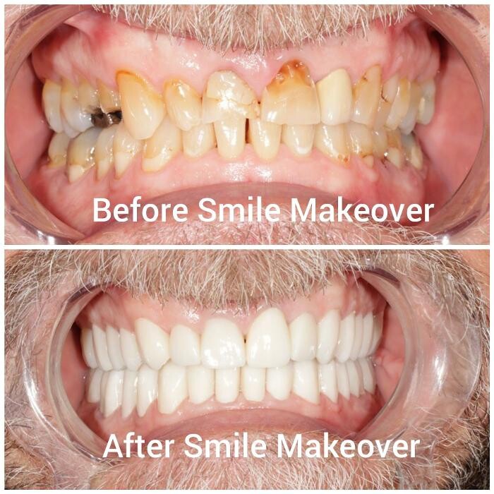 Images Supreme Dental Clinic