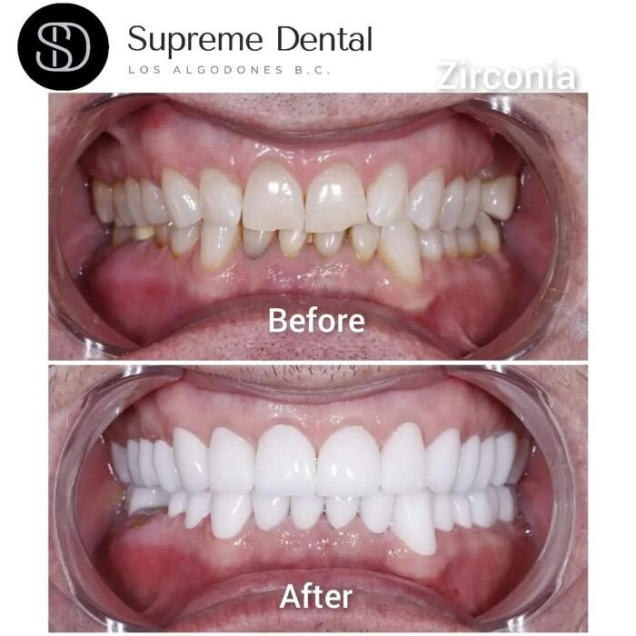 Images Supreme Dental Clinic