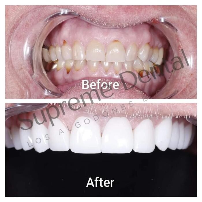 Images Supreme Dental Clinic