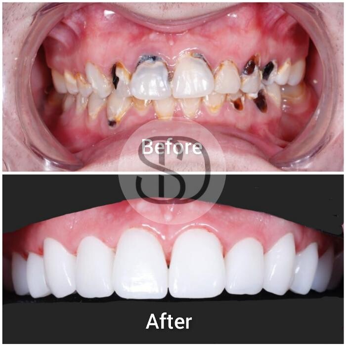 Images Supreme Dental Clinic