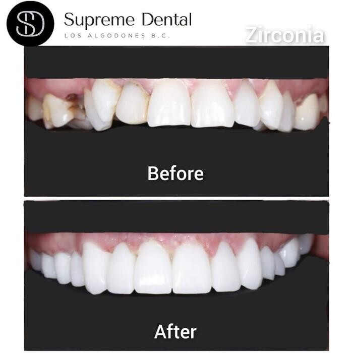 Images Supreme Dental Clinic
