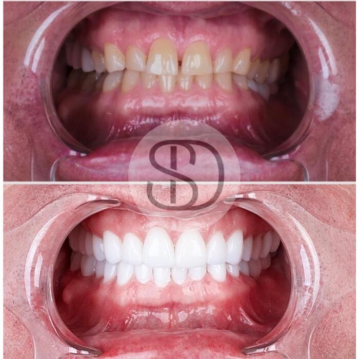 Images Supreme Dental Clinic