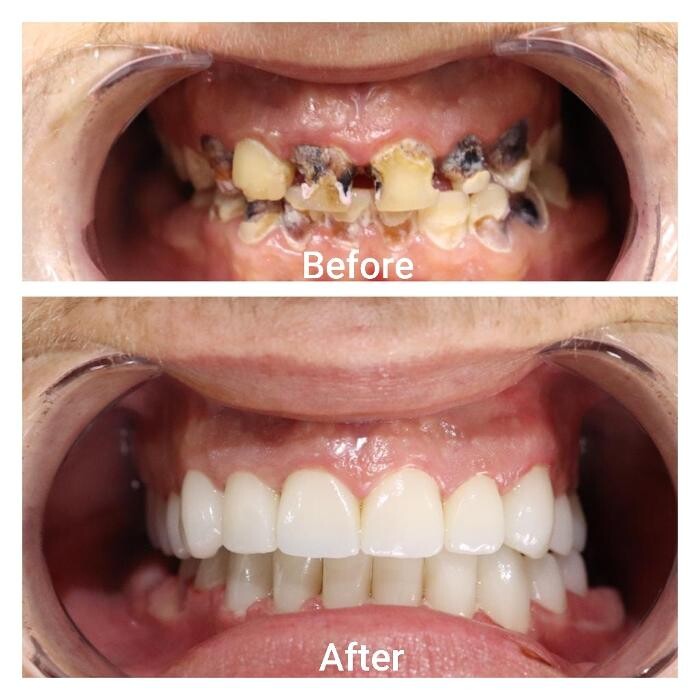 Images Supreme Dental Clinic