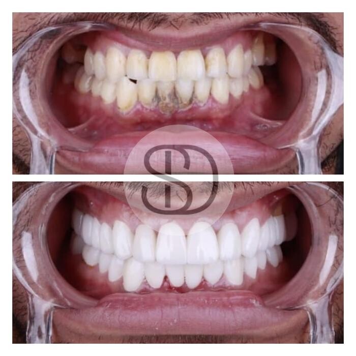 Images Supreme Dental Clinic