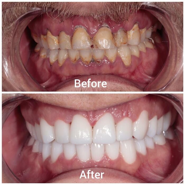 Images Supreme Dental Clinic