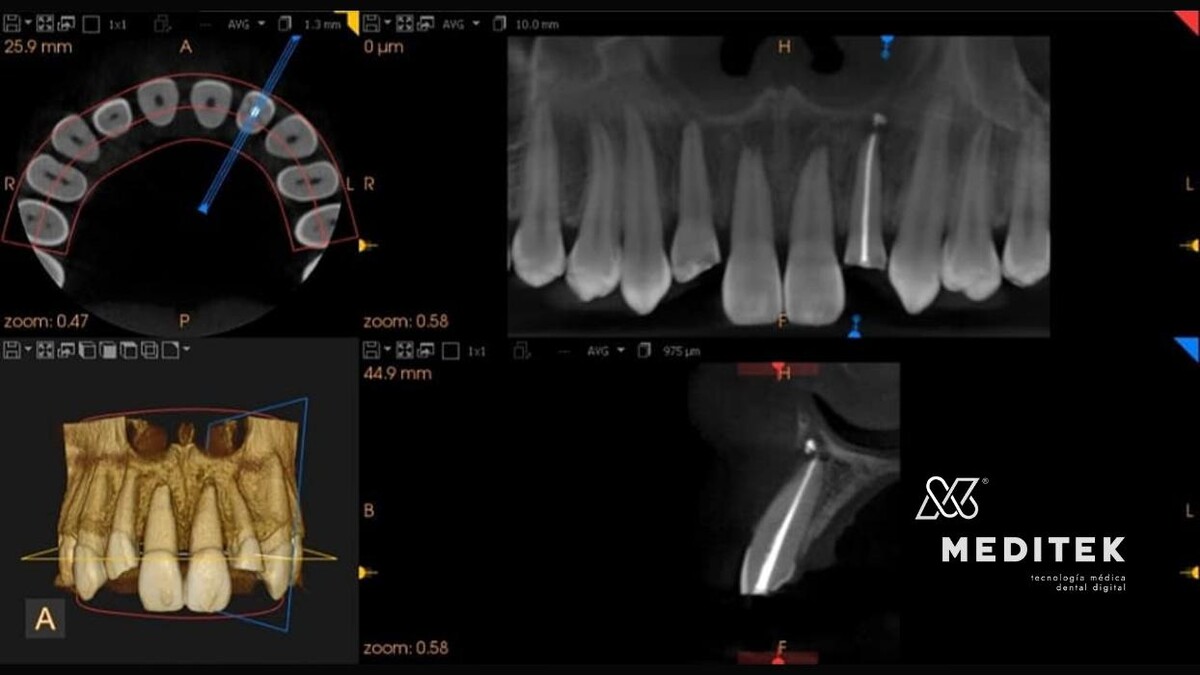 Images Meditek Sucursal Juan Palomar y Arias