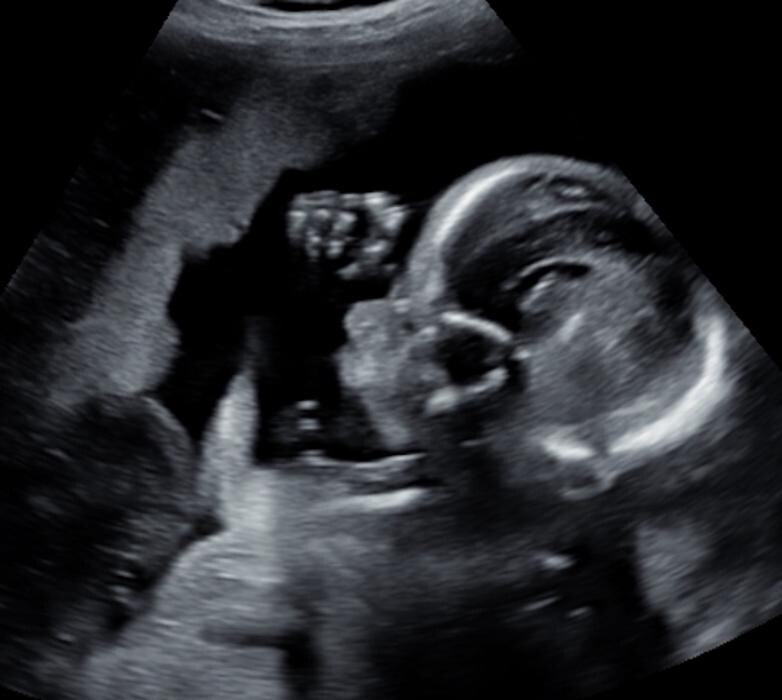 Foto's Mama's Babybuik