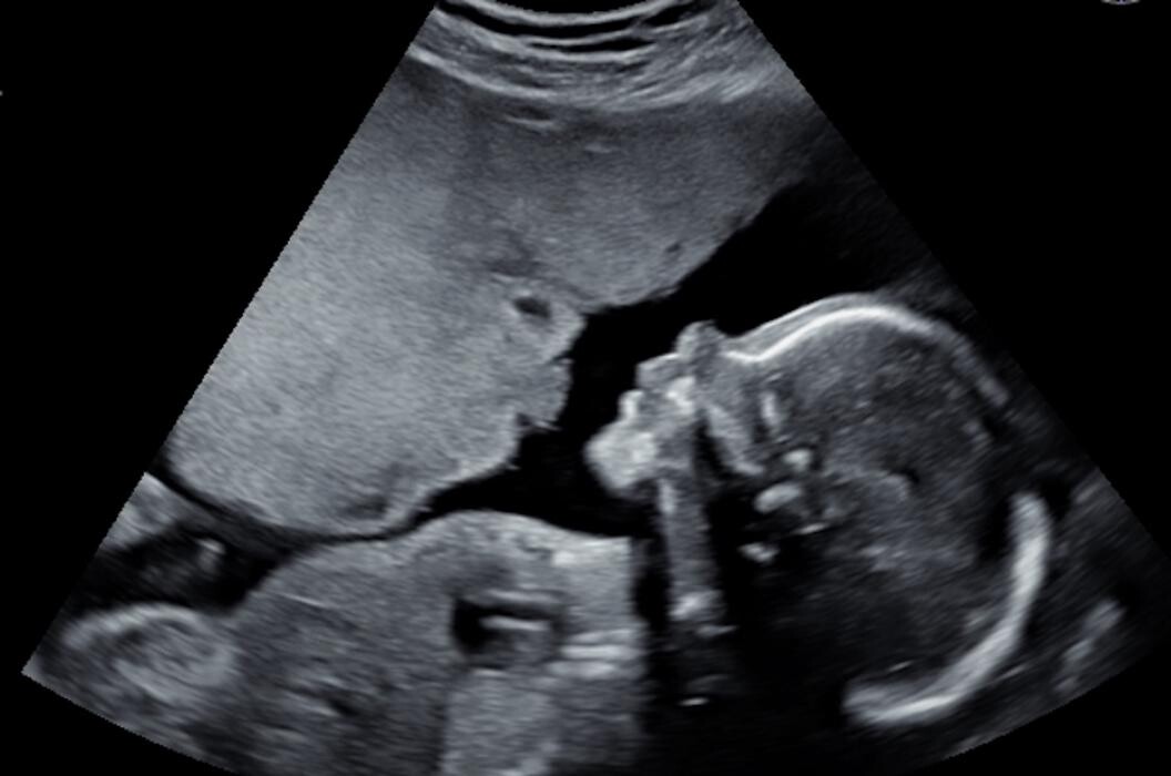 Foto's Mama's Babybuik