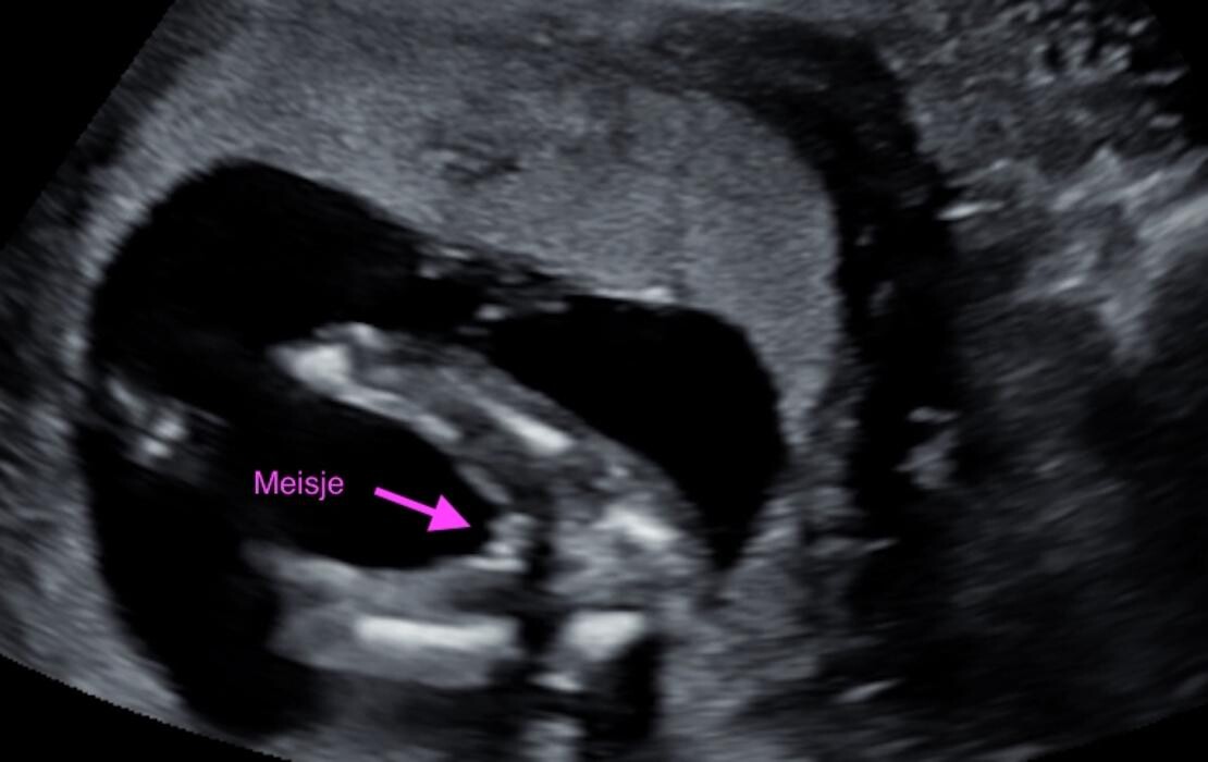 Foto's Mama's Babybuik