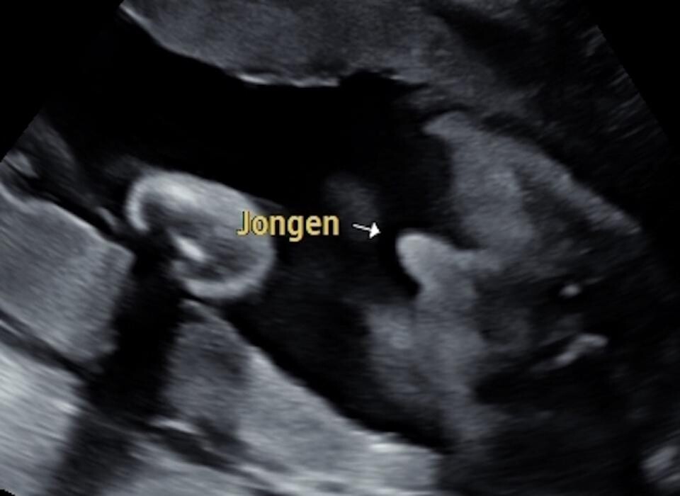 Foto's Mama's Babybuik