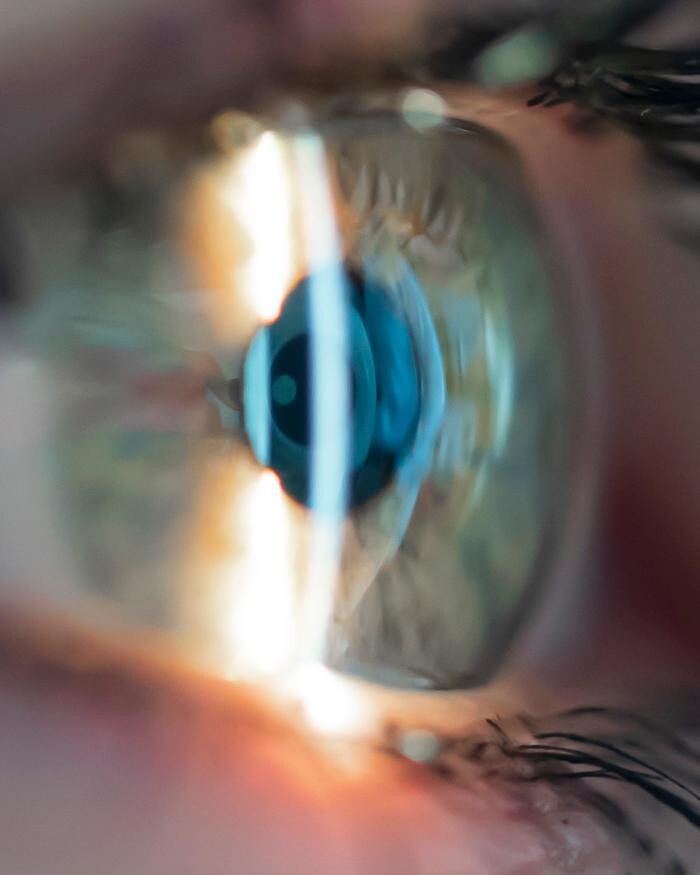 Foto's Hans Anders Opticien Boxmeer