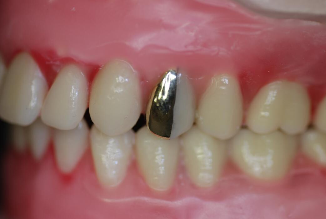 Foto's Ronald van der Linden Tandtechniek BV